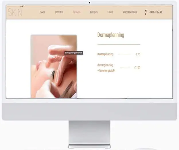 website laten maken voor skinbywidad
